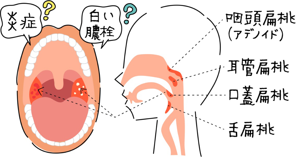 息苦しい 喉 の 違和感